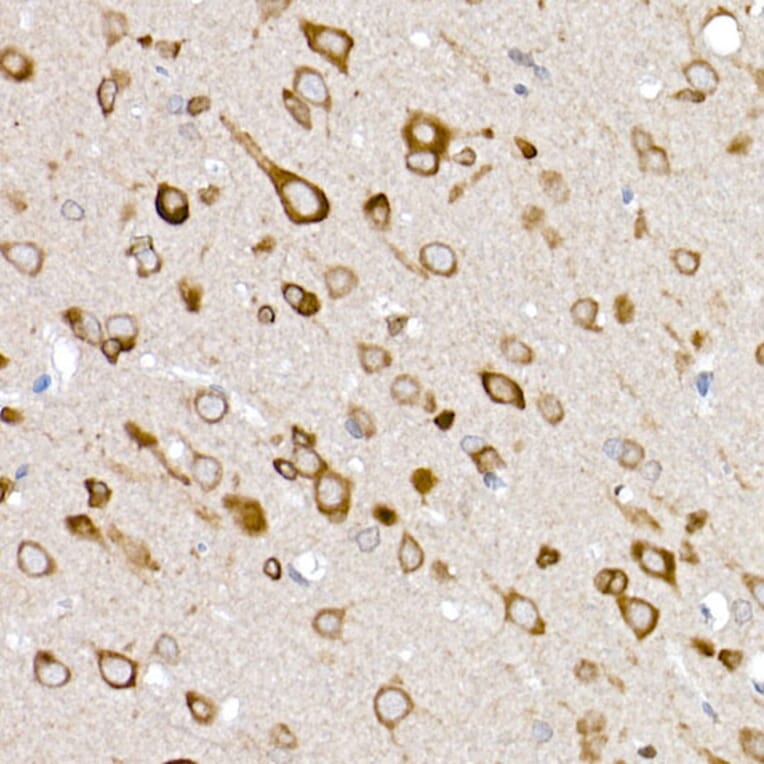 Immunohistochemistry - Anti-Glucose Transporter GLUT3 Antibody (A16090) - Antibodies.com