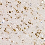 Immunohistochemistry - Anti-Glucose Transporter GLUT3 Antibody (A16090) - Antibodies.com