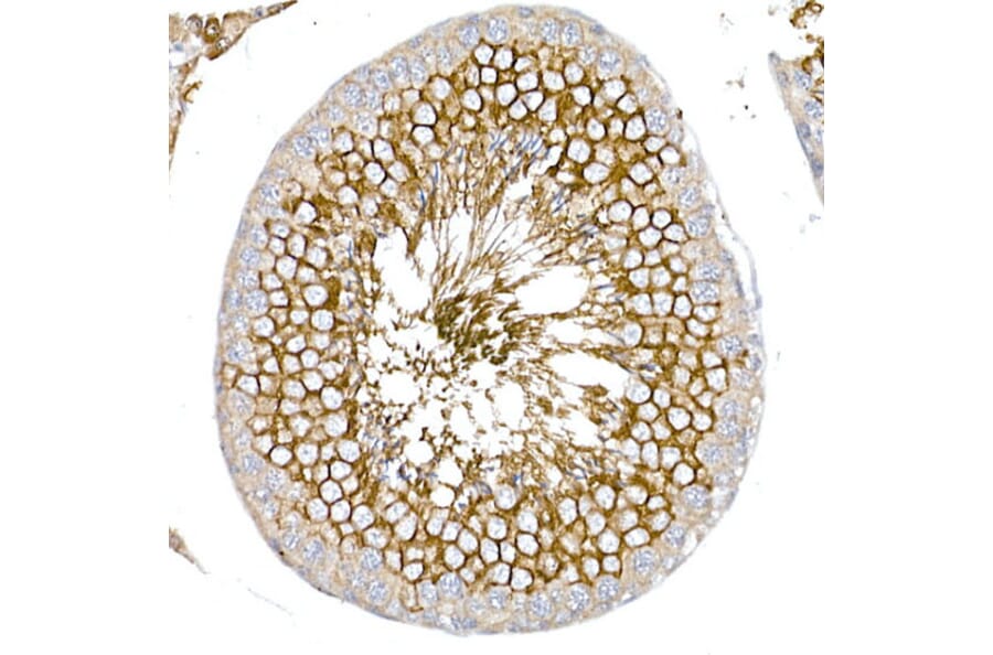 Immunohistochemistry - Anti-Glucose Transporter GLUT3 Antibody (A16090) - Antibodies.com