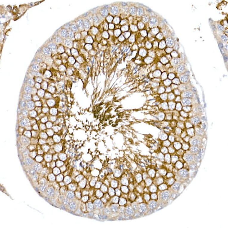 Immunohistochemistry - Anti-Glucose Transporter GLUT3 Antibody (A16090) - Antibodies.com