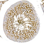 Immunohistochemistry - Anti-Glucose Transporter GLUT3 Antibody (A16090) - Antibodies.com