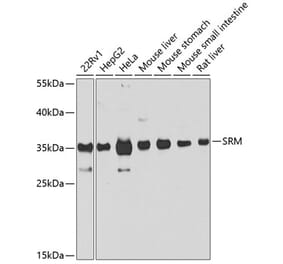 Western Blot - Anti-Spermidine synthase Antibody (A16091) - Antibodies.com