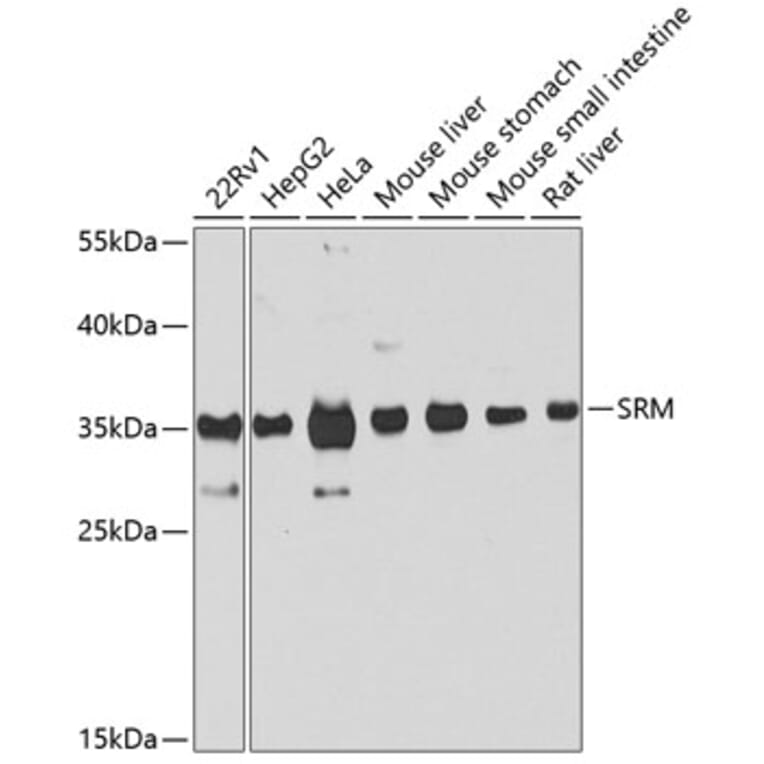 Western Blot - Anti-Spermidine synthase Antibody (A16091) - Antibodies.com