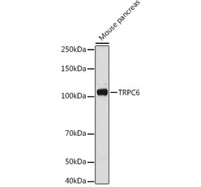 Western Blot - Anti-TRPC6 Antibody (A16093) - Antibodies.com