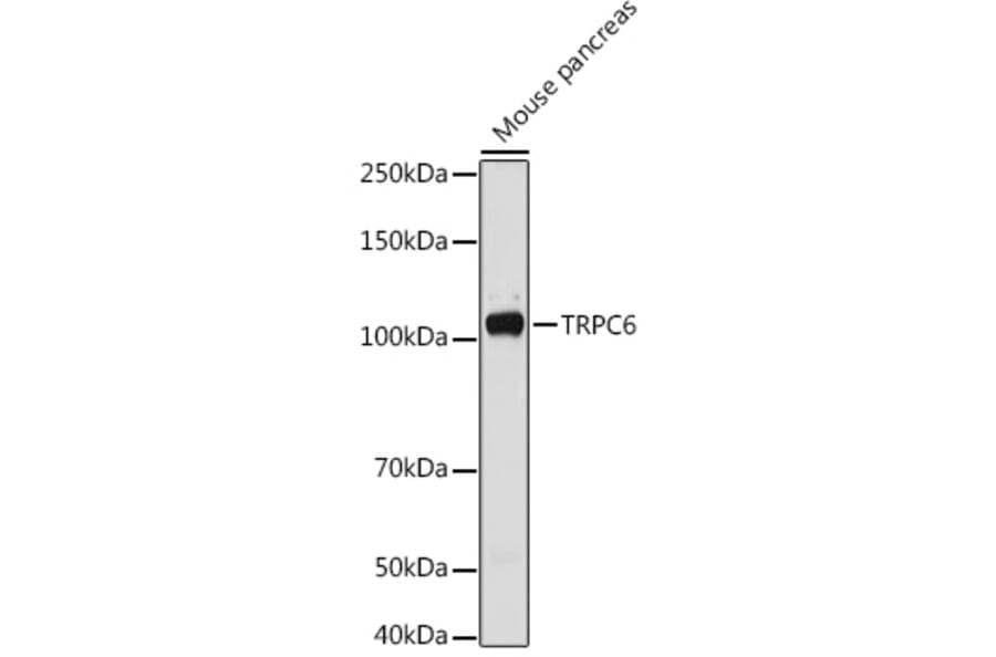 Western Blot - Anti-TRPC6 Antibody (A16093) - Antibodies.com