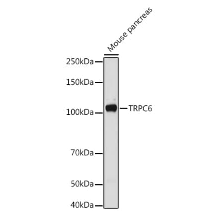 Western Blot - Anti-TRPC6 Antibody (A16093) - Antibodies.com