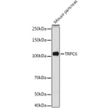 Western Blot - Anti-TRPC6 Antibody (A16093) - Antibodies.com