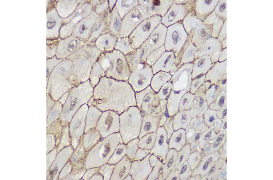 Immunohistochemistry - Anti-TRPC6 Antibody (A16093) - Antibodies.com