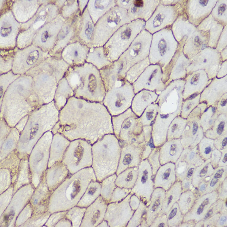 Immunohistochemistry - Anti-TRPC6 Antibody (A16093) - Antibodies.com