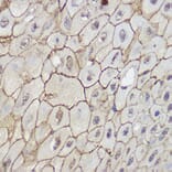 Immunohistochemistry - Anti-TRPC6 Antibody (A16093) - Antibodies.com