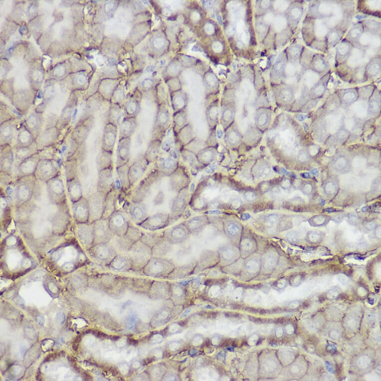 Immunohistochemistry - Anti-TRPC6 Antibody (A16093) - Antibodies.com
