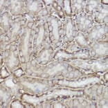 Immunohistochemistry - Anti-TRPC6 Antibody (A16093) - Antibodies.com