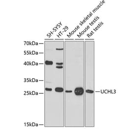 Western Blot - Anti-UCHL3 Antibody (A16094) - Antibodies.com