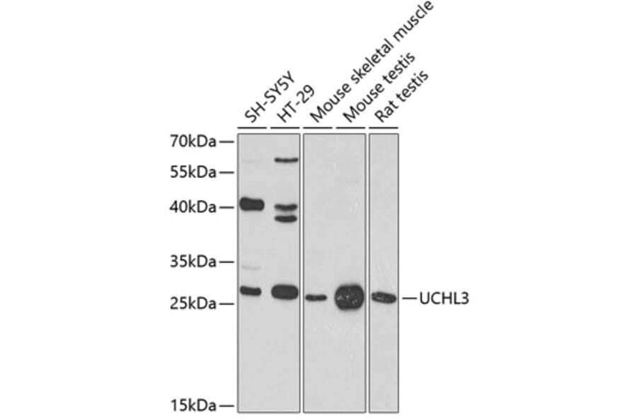 Western Blot - Anti-UCHL3 Antibody (A16094) - Antibodies.com