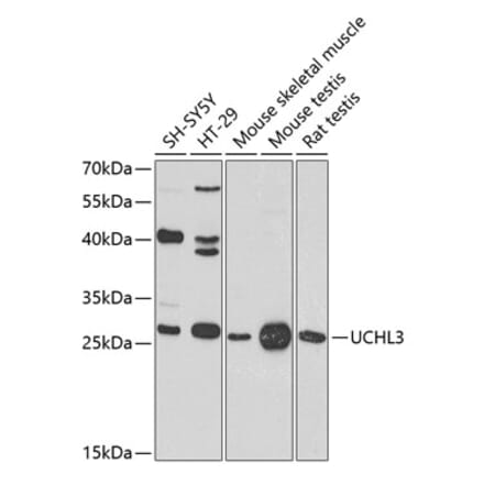 Western Blot - Anti-UCHL3 Antibody (A16094) - Antibodies.com