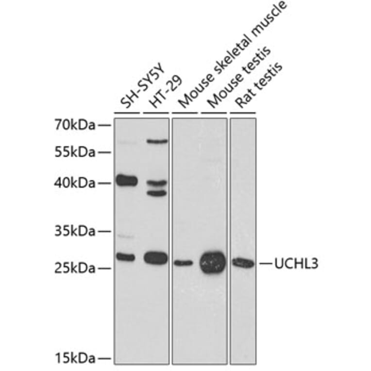 Western Blot - Anti-UCHL3 Antibody (A16094) - Antibodies.com