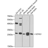 Western Blot - Anti-UCHL3 Antibody (A16094) - Antibodies.com