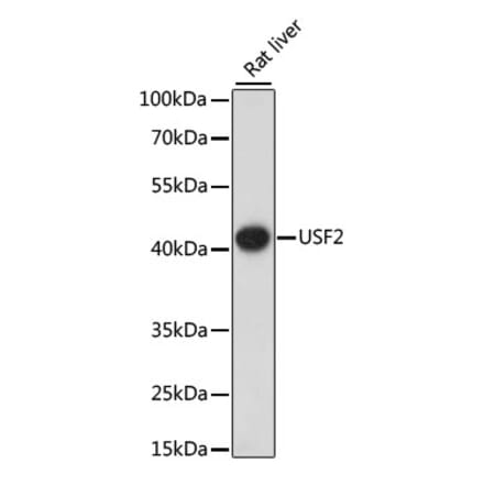 Western Blot - Anti-FIP Antibody (A16095) - Antibodies.com