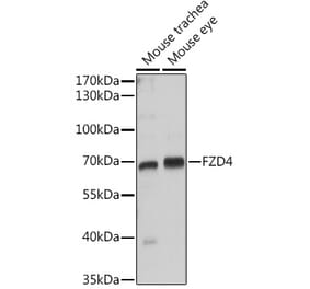 Western Blot - Anti-Frizzled 4 Antibody (A16096) - Antibodies.com