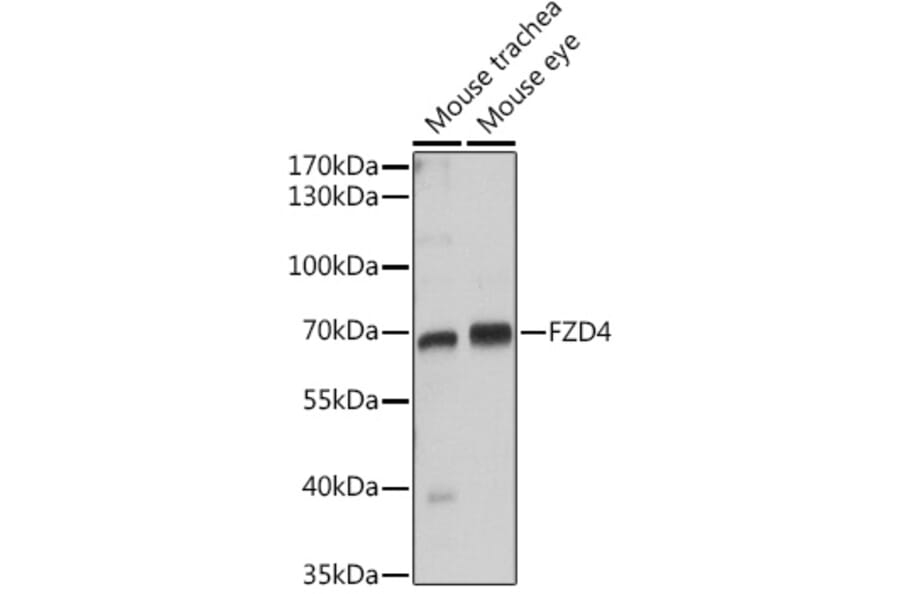 Western Blot - Anti-Frizzled 4 Antibody (A16096) - Antibodies.com