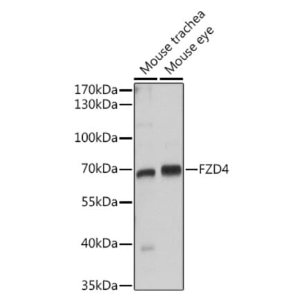 Western Blot - Anti-Frizzled 4 Antibody (A16096) - Antibodies.com