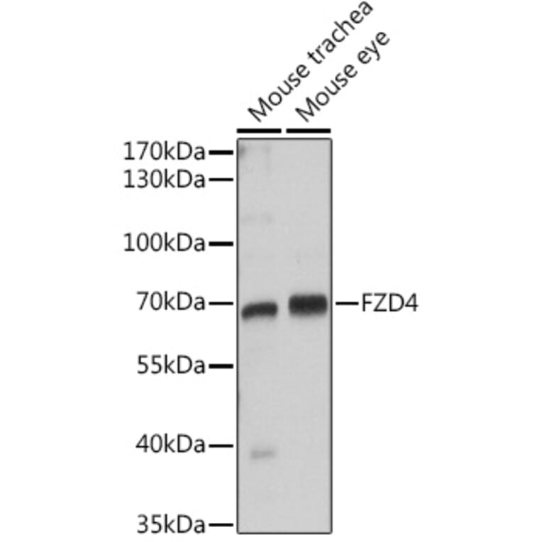 Western Blot - Anti-Frizzled 4 Antibody (A16096) - Antibodies.com