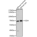 Western Blot - Anti-Frizzled 4 Antibody (A16096) - Antibodies.com