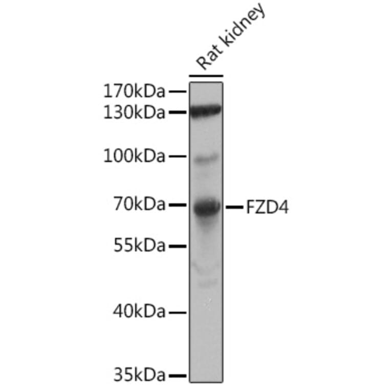 Western Blot - Anti-Frizzled 4 Antibody (A16096) - Antibodies.com