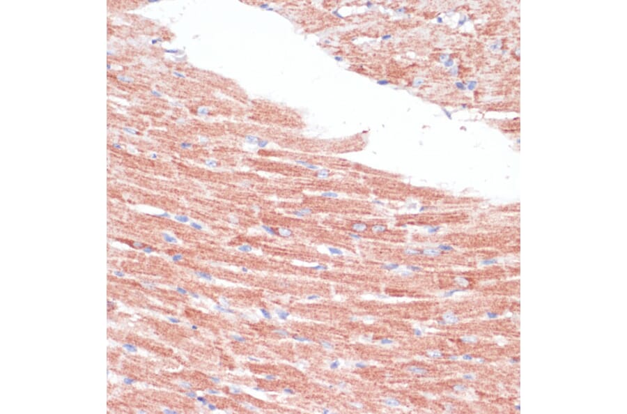 Immunohistochemistry - Anti-Frizzled 4 Antibody (A16096) - Antibodies.com