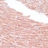 Immunohistochemistry - Anti-Frizzled 4 Antibody (A16096) - Antibodies.com