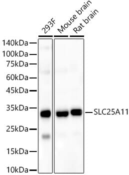 Western blot analysis of extracts of various cell lines, using Anti-SLC25A11 Antibody (A8163) at 1:1,000 dilution.
Secondary antibody: Goat Anti-Rabbit IgG (H+L) (HRP) (AS014) at 1:10,000 dilution.
Lysates / proteins: 25µg per lane.
Blocking buffer: 3% non-fat dry milk in TBST.
Detection: ECL Basic Kit (RM00020).
Exposure time: 10s.
