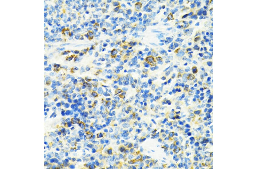 Immunohistochemistry - Anti-SLC25A11 Antibody (A16098) - Antibodies.com