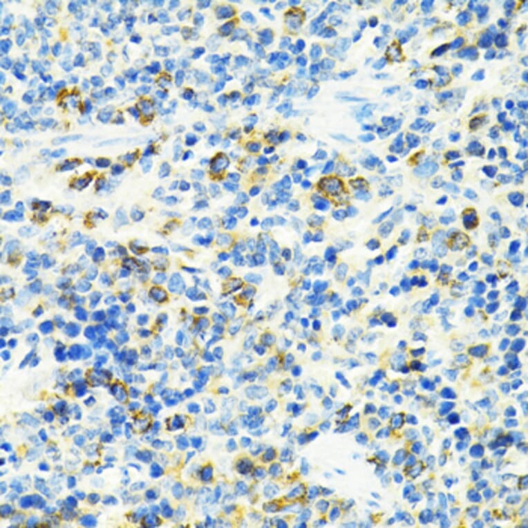 Immunohistochemistry - Anti-SLC25A11 Antibody (A16098) - Antibodies.com