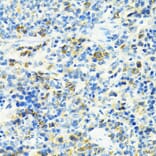 Immunohistochemistry - Anti-SLC25A11 Antibody (A16098) - Antibodies.com