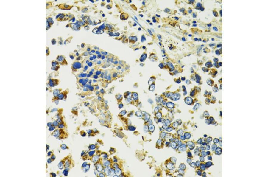 Immunohistochemistry - Anti-SLC25A11 Antibody (A16098) - Antibodies.com