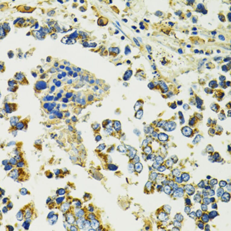 Immunohistochemistry - Anti-SLC25A11 Antibody (A16098) - Antibodies.com