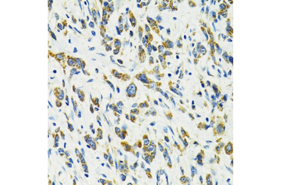 Immunohistochemistry - Anti-SLC25A11 Antibody (A16098) - Antibodies.com