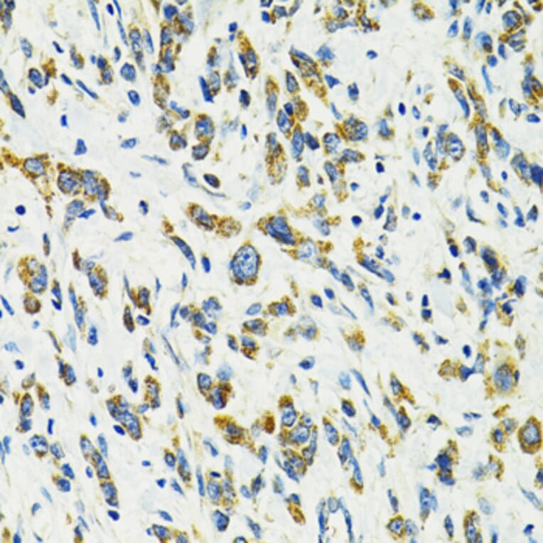 Immunohistochemistry - Anti-SLC25A11 Antibody (A16098) - Antibodies.com