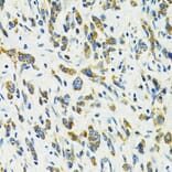 Immunohistochemistry - Anti-SLC25A11 Antibody (A16098) - Antibodies.com