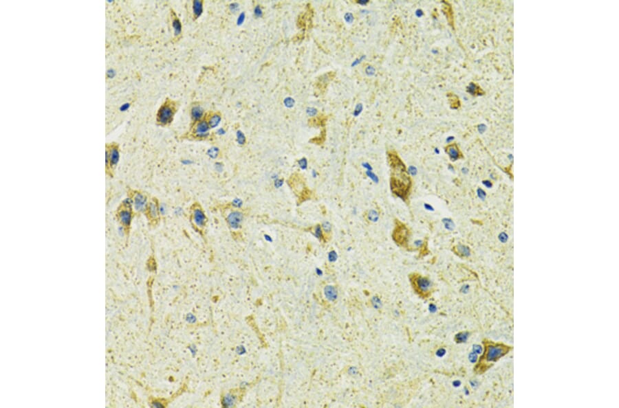 Immunohistochemistry - Anti-SLC25A11 Antibody (A16098) - Antibodies.com