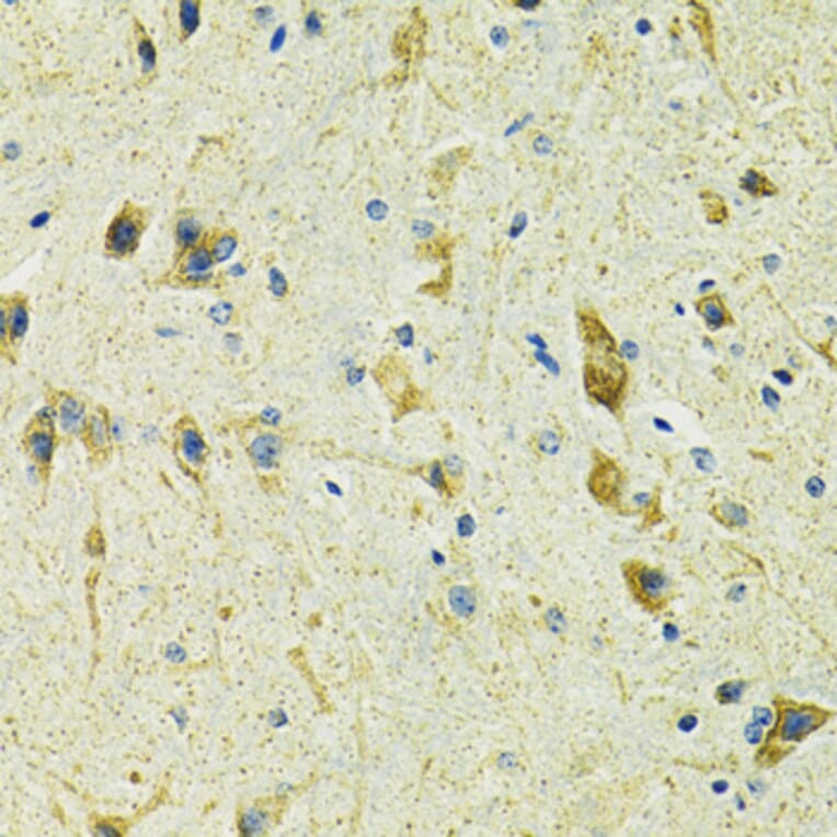 Immunohistochemistry - Anti-SLC25A11 Antibody (A16098) - Antibodies.com
