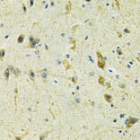 Immunohistochemistry - Anti-SLC25A11 Antibody (A16098) - Antibodies.com