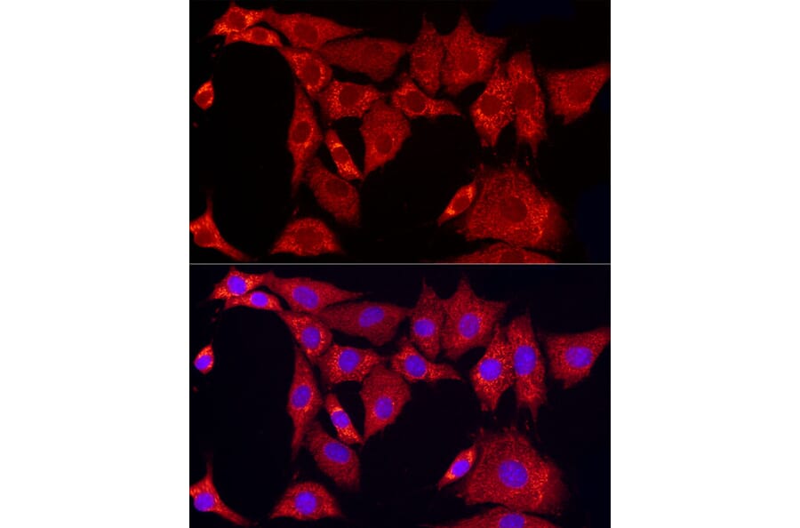 Immunofluorescence - Anti-SLC25A11 Antibody (A16098) - Antibodies.com
