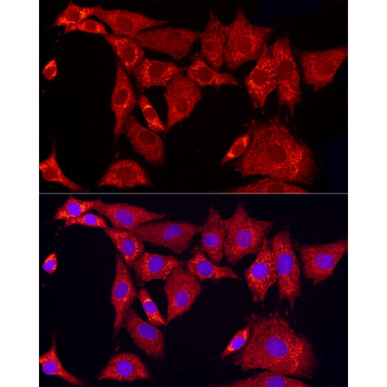Immunofluorescence - Anti-SLC25A11 Antibody (A16098) - Antibodies.com