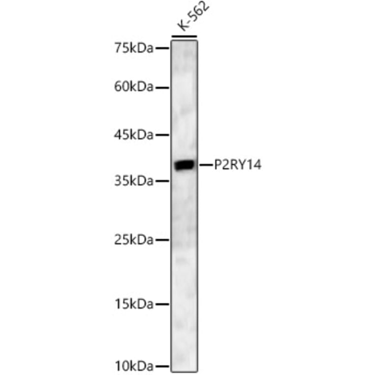 Western Blot - Anti-P2Y14 Antibody (A16099) - Antibodies.com