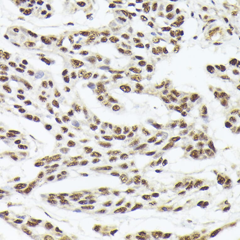 Immunohistochemistry - Anti-Nuclear Matrix Protein p84 Antibody (A16100) - Antibodies.com