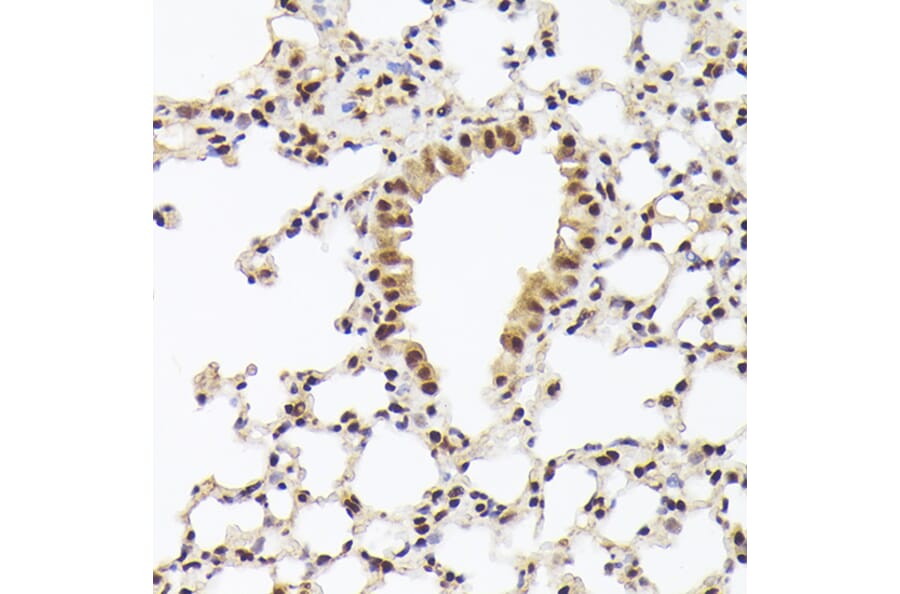 Immunohistochemistry - Anti-Nuclear Matrix Protein p84 Antibody (A16100) - Antibodies.com