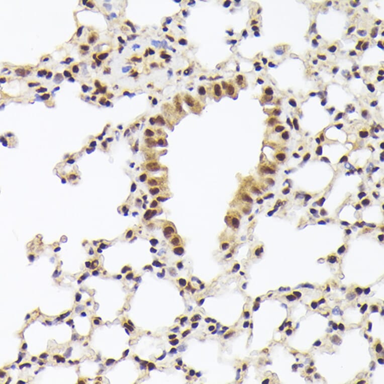 Immunohistochemistry - Anti-Nuclear Matrix Protein p84 Antibody (A16100) - Antibodies.com