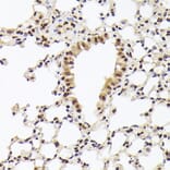 Immunohistochemistry - Anti-Nuclear Matrix Protein p84 Antibody (A16100) - Antibodies.com