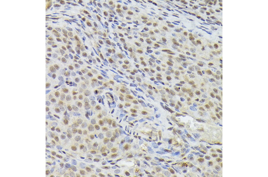 Immunohistochemistry - Anti-Nuclear Matrix Protein p84 Antibody (A16100) - Antibodies.com